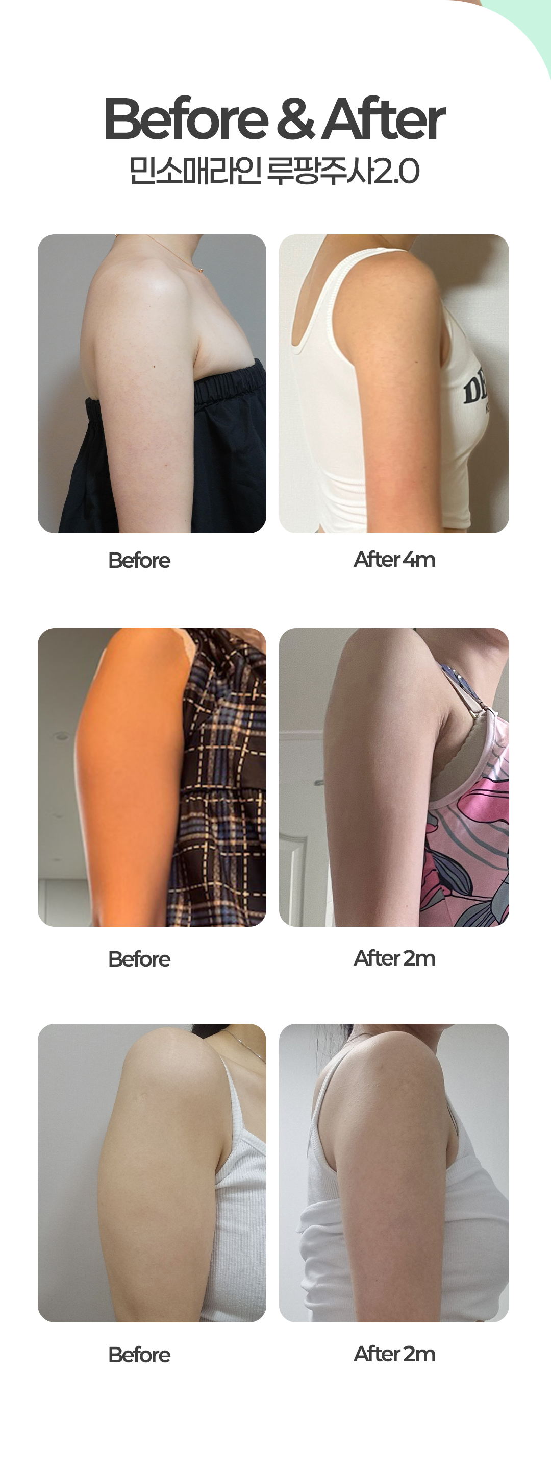 Before & After